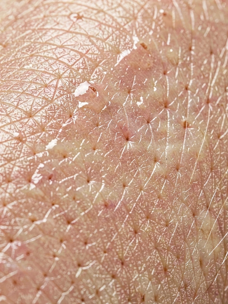 Detailní textura hydratované pleti